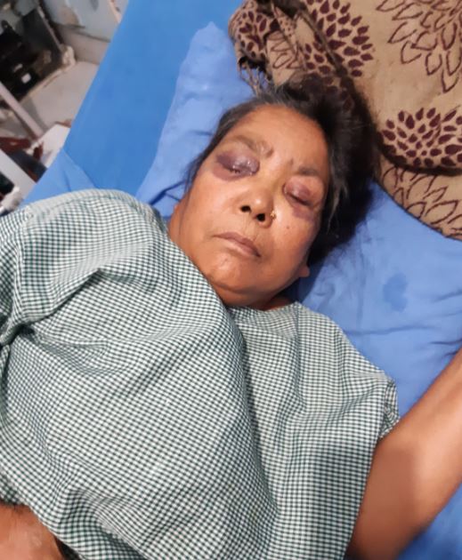 लेटाङमा ७० वर्षिया वृद्धामाथि निर्घात कुटपिट, दुइजना पक्राउ