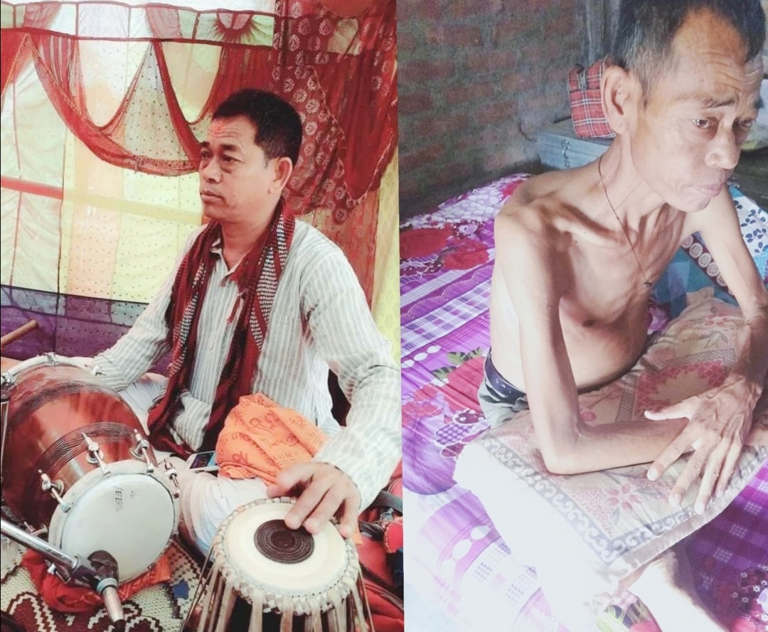 उपचार खर्चको अभावमा छट्पटाउँदै बेलबारीका एक कलाकार, भन्छन् – ‘मलाई बचाइदिनुहाेस्’